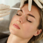 Botox Injections for Softening Lines Around the Mouth Area