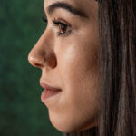 When Can You Return to Work After Rhinoplasty?