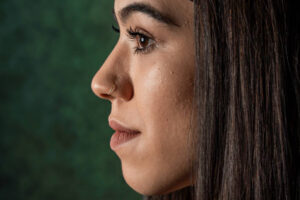 When Can You Return to Work After Rhinoplasty?