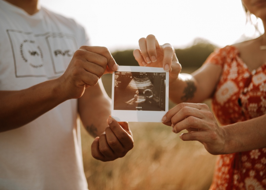 gender-reveal-reasons-singapore-omar-lopez-ulitrasound (1)