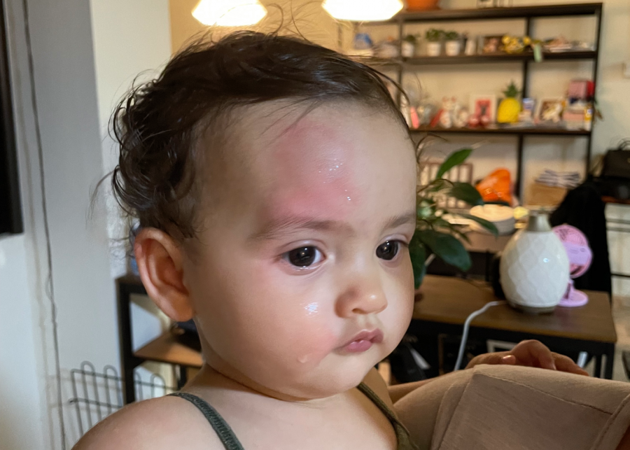 Jill-Lim-HKA-article-head-injuries-kids-singapore