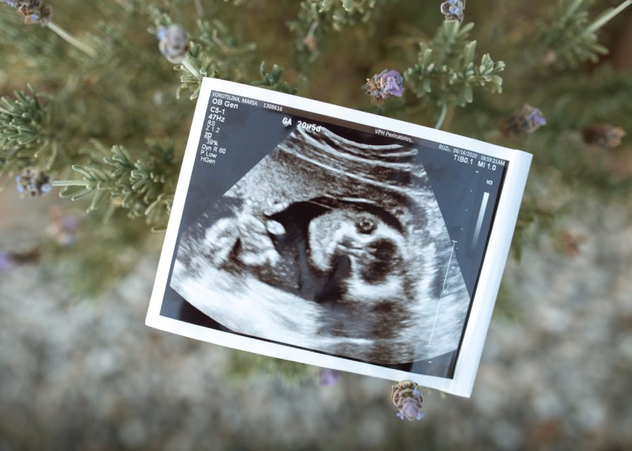 baby-keepsakes-singapore-pregnancy-sonogram