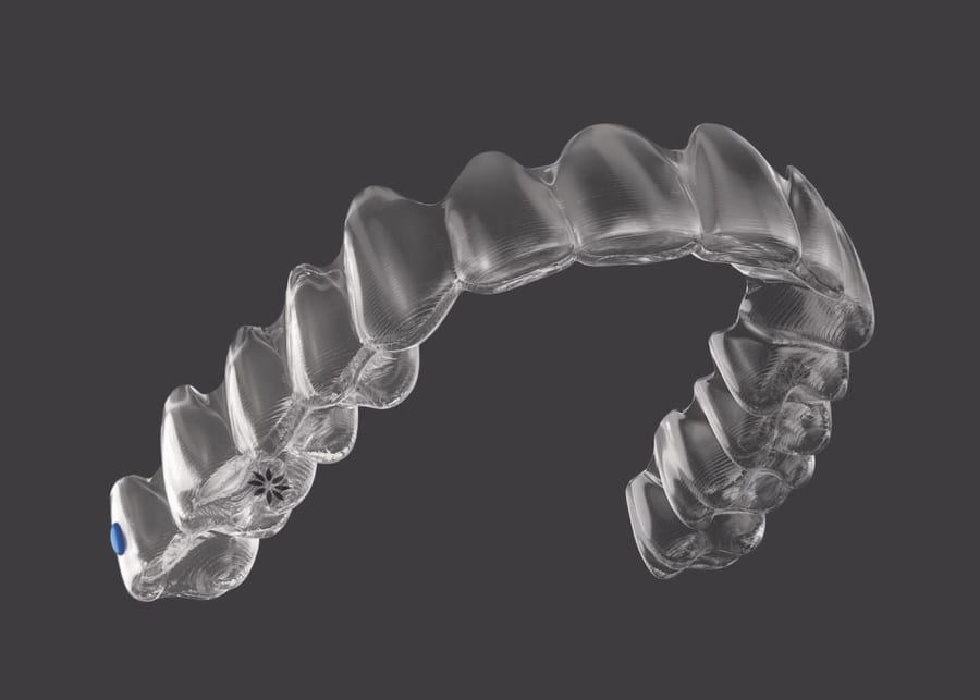 Invisalign or traditional braces for teens: The pros and cons | HoneyKids