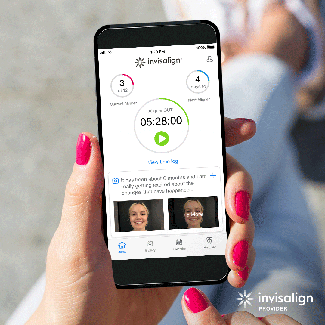 Invisalign for teens progress | HoneyKids