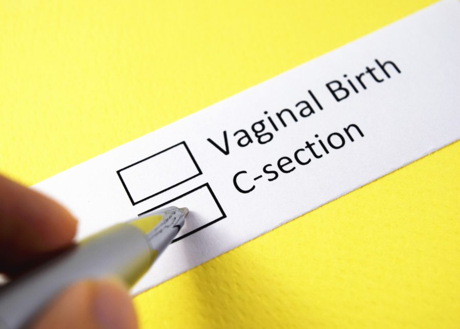 c-section-birth