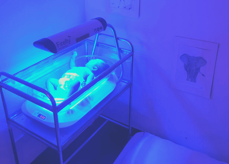 phototherapy bed rental singapore jaundice