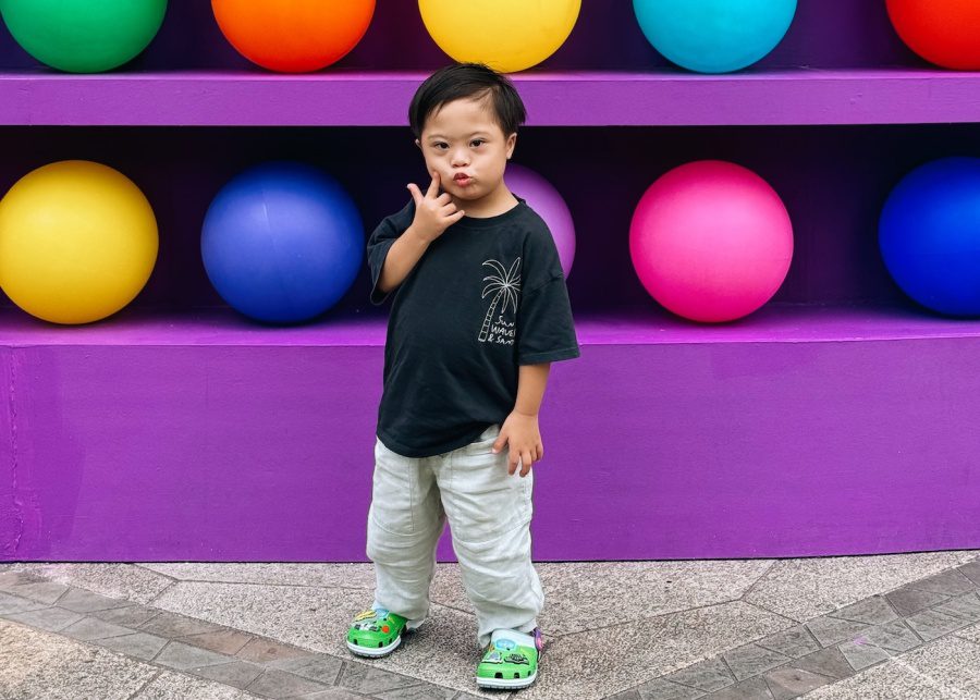 hidayah ayaan hafi toddler down syndrome awareness