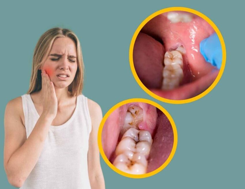 wisdom tooth pain 1024x790 1