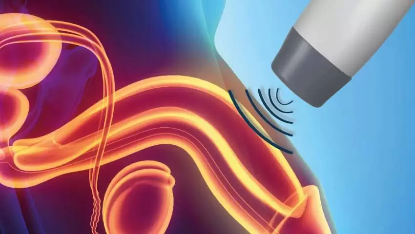 Shock Wave Therapy for Erectile Dysfunction