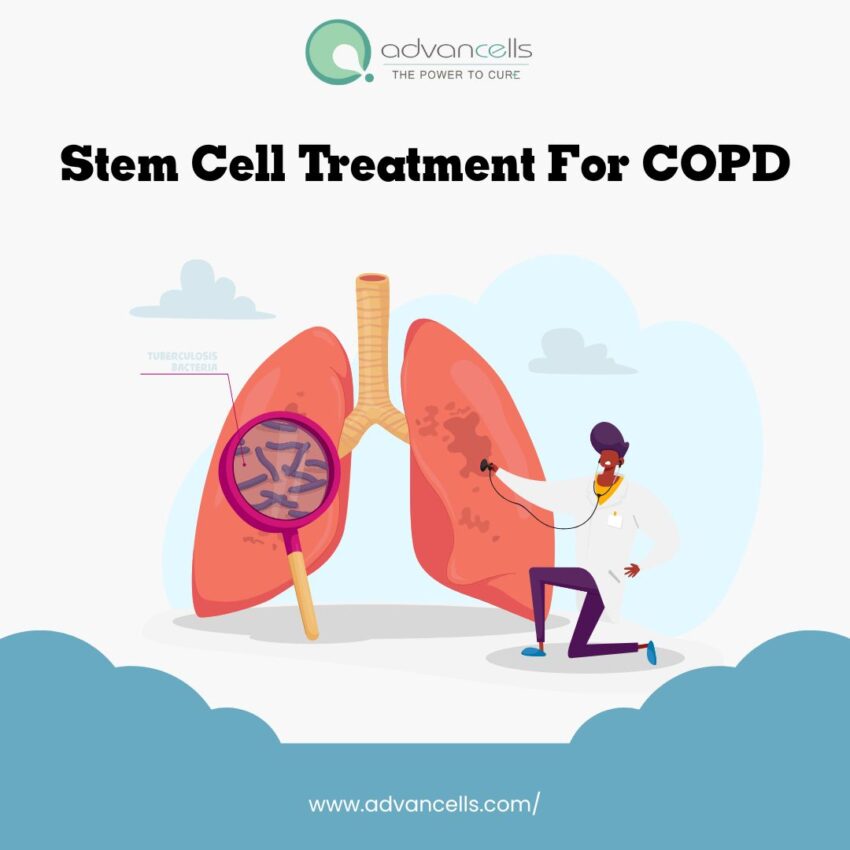 Stem Cell Treatment for COPD