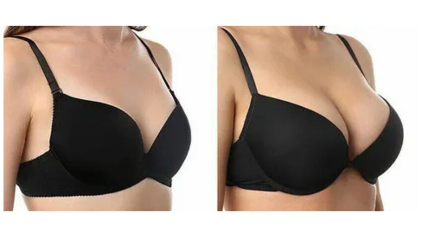 Breast Augmentation in Delhi Safe Natural Expert Led Enhancement