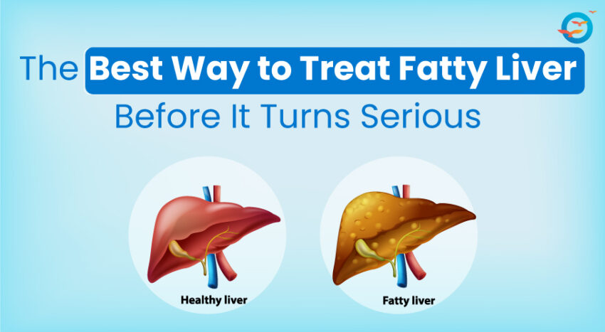Fatty liver Featured