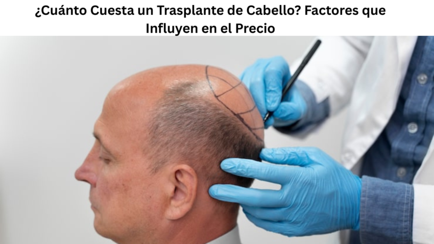 %C2%BFCuanto Cuesta un Trasplante de Cabello Factores que Influyen en el Precio 1