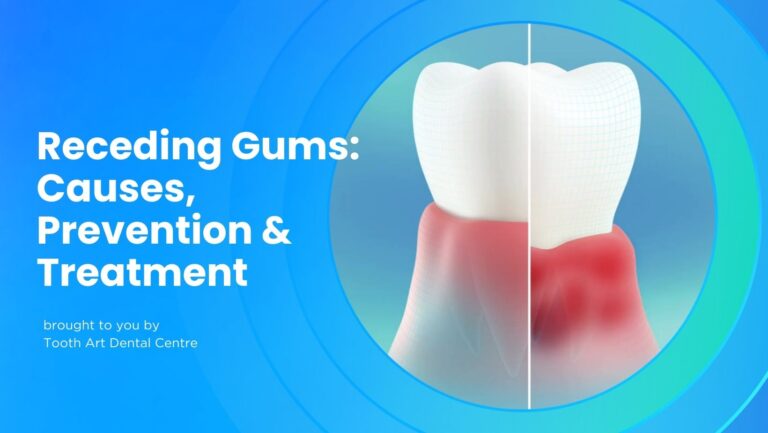 Week 12 Receding Gums 768x433 1