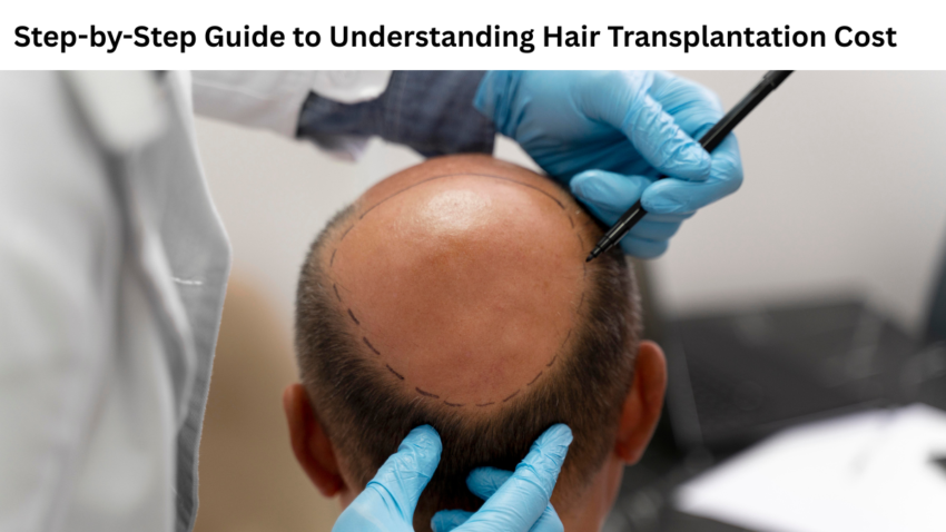 Step by Step Guide to Understanding Hair Transplantation Cost 1 1