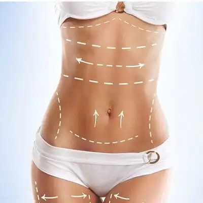 360 Body Contouring in Riyadh