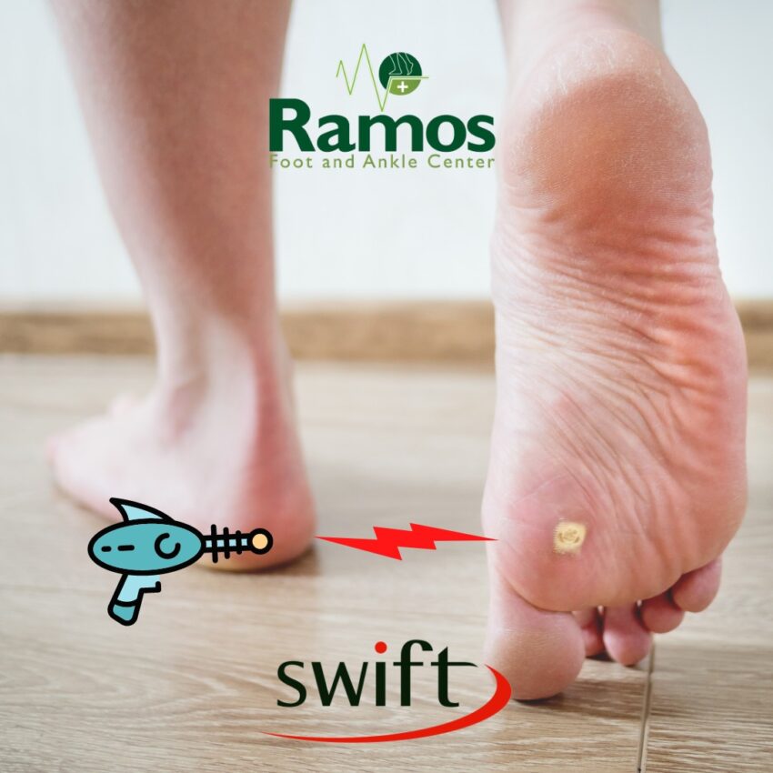 PLANTAR WARTS