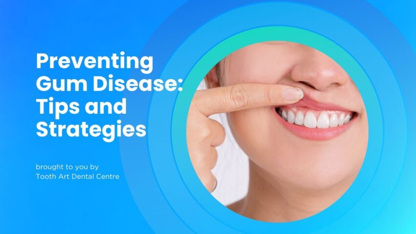 Week 10 Preventing Gum Diseases