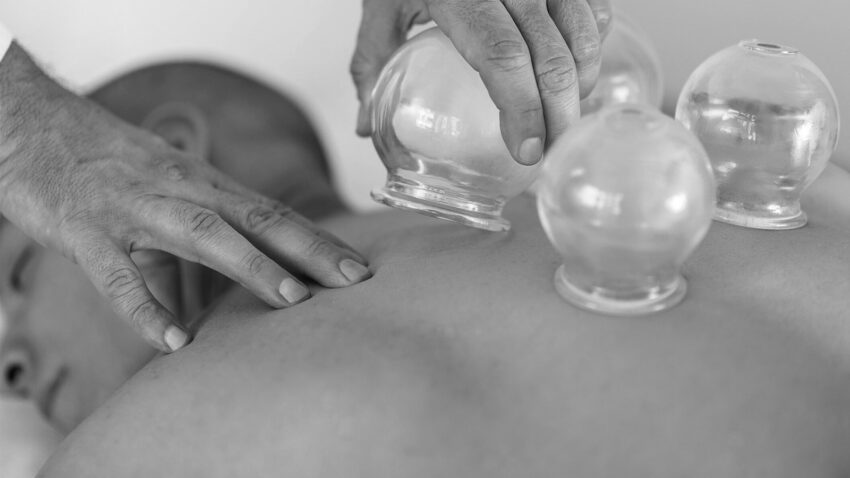 cupping brighton east 1920x1080 1