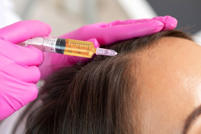 Does G Cell Hair Treatment Help With Bald Spots