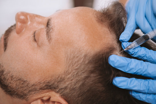 Does Dermatologists Recommend GFC for Hair Health