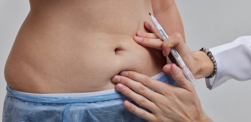 Why Are Fat Melting Injections Gaining Popularity