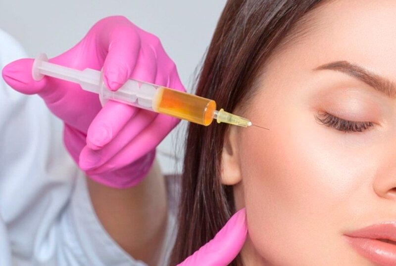 Why Are Filler Injections with PRP in High Demand