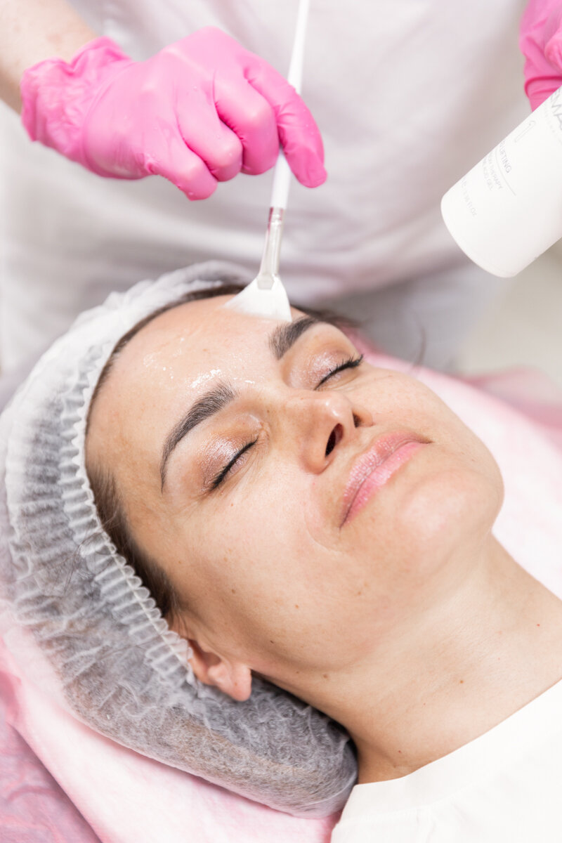 How Effective Is Inno Peel Against Uneven Skin Ton