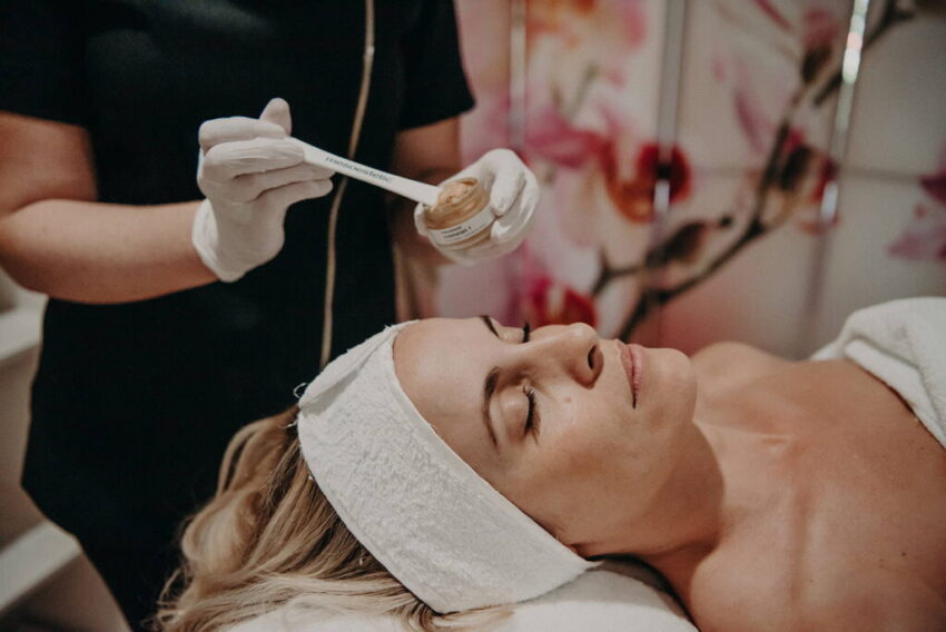 Can Cosmelan Peel Fade Stubborn Melasma Patches
