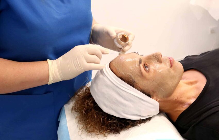 Can Cosmelan Peel Treatment Fade Dark Skin Spots Naturall