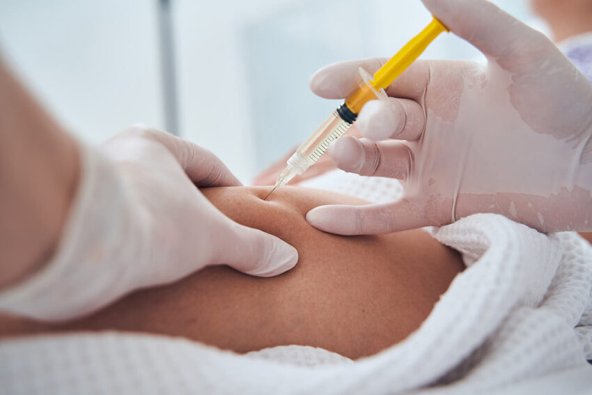 Can Body Fillers Improve Body Proportions Naturally