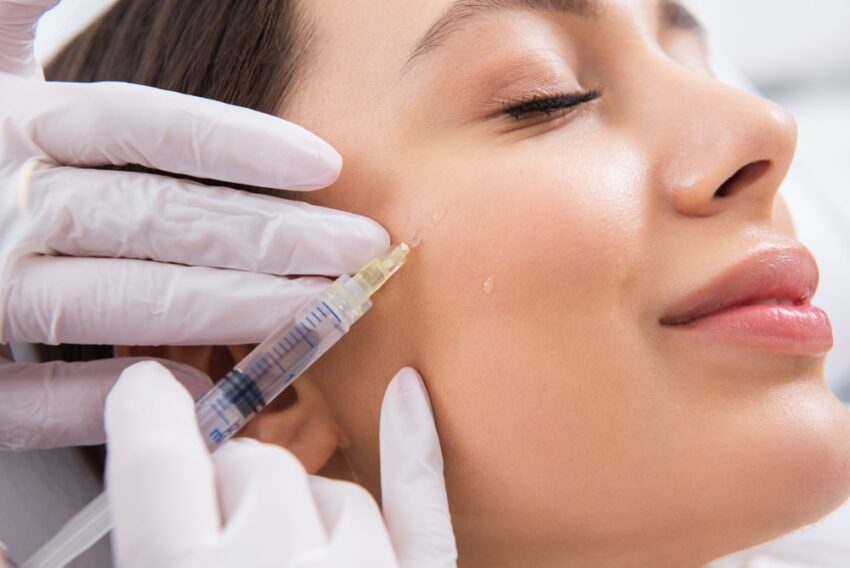Can Dermal Fillers Help with Acne Scars