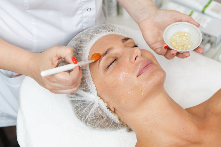 Can chemical peels enhance skin hydration and glow