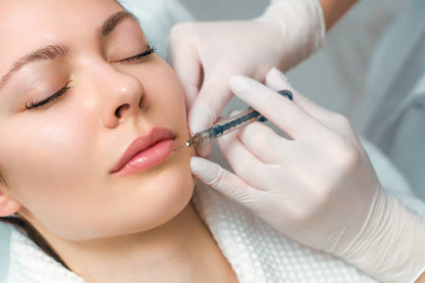Do Lip Fillers Enhance Overall Facial Aesthetics