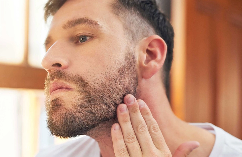 Can Beard Hair Transplant Replace Missing Beard Hair