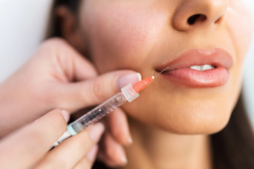 Is Lip Filler a Popular Choice for Lip Enhancement