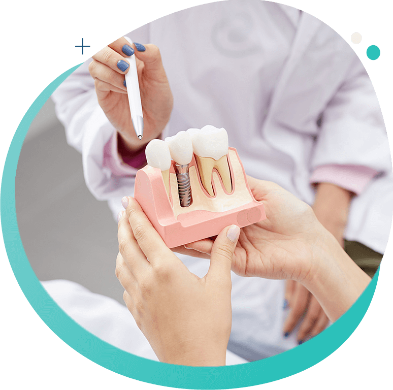 dental implants 1