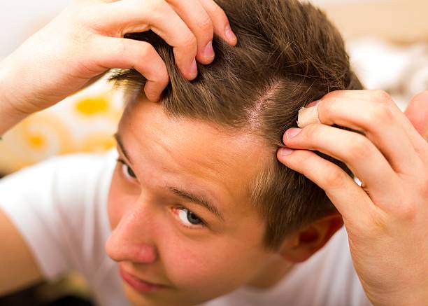 FUE Hair Transplant in Riyadh 49 1