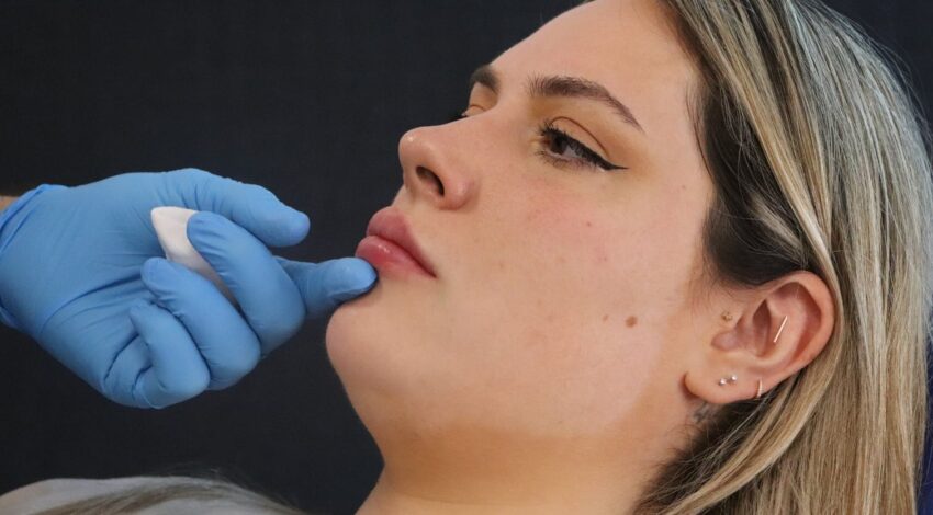 How Long Can Lip Filler Injections Maintain Their Effect