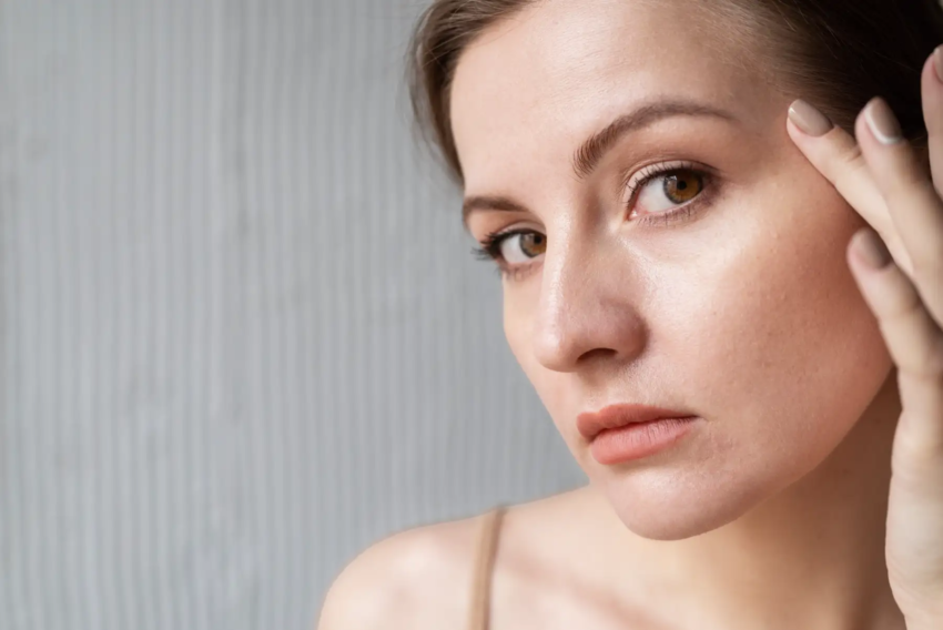 Dark Circles Under Eyes