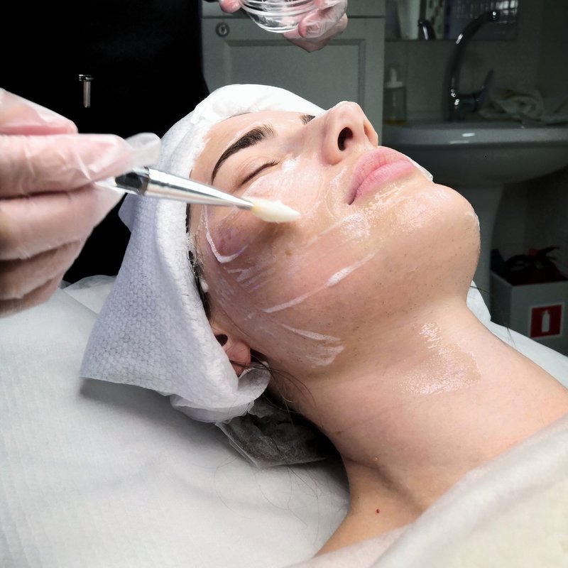 How Chemical Peel Treatment Improves Skincare Product Absorption