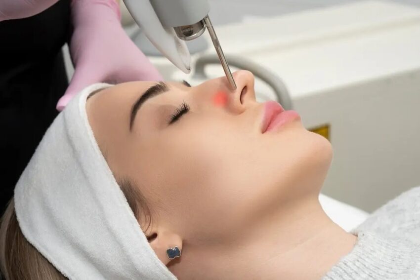 Advanced Laser Melasma Treatment Explained