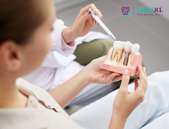 Dental Implant Treatment