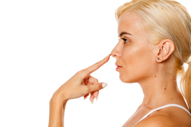 Rhinoplasty in Riyadh 82