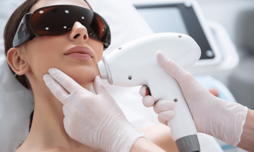 How Long Do Results From Facial Laser Hair Removal Last