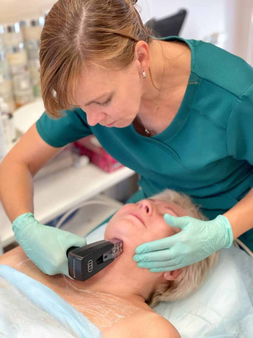 Why Is Morpheus8 Skin Tightening So Popular Today