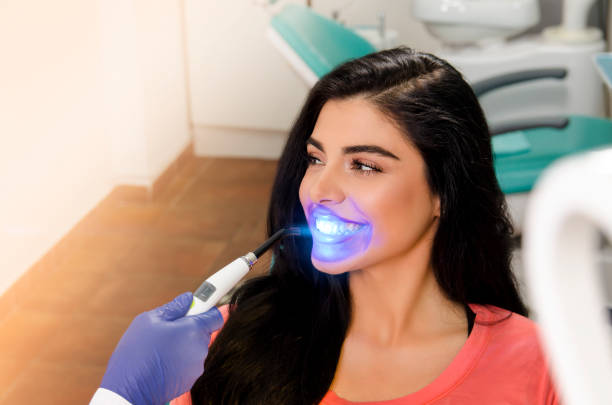 teeth whitening 1