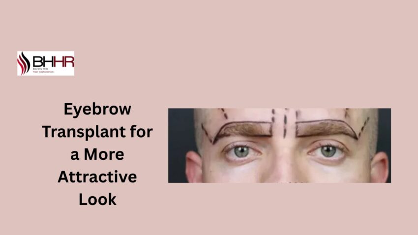 Eyebrow Transplant for a More Attractive Look