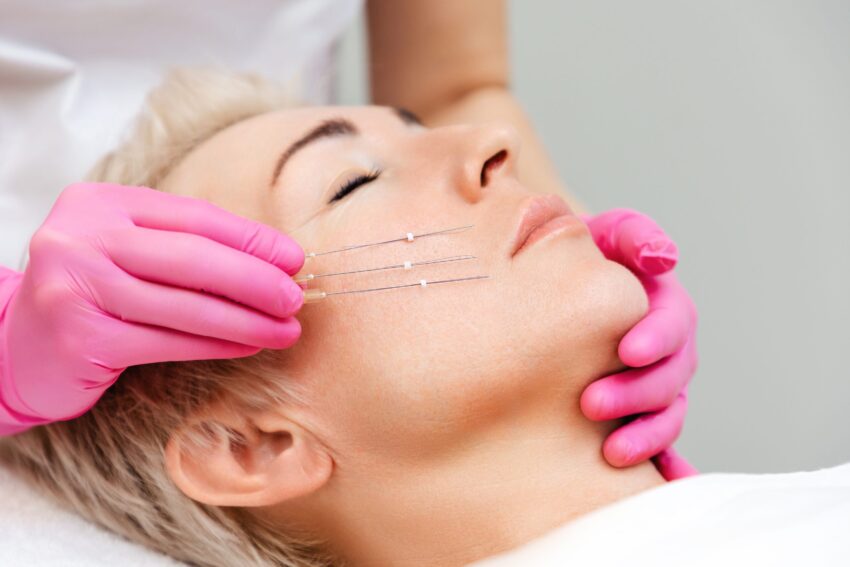 Can PDO Mono Threads Help Restore Skin Tightness