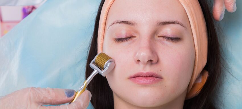 Can Microneedling Help Delay Visible Skin Aging Signs